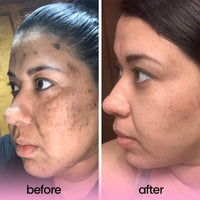Turmeric Acid Cleansing Pads for dark spots by Dune Glow