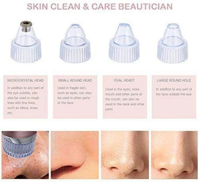 5-in-1 Pore Vacuum Cleaner & Blackhead Remover Tool (5 Suction Levels & 4 Probes)